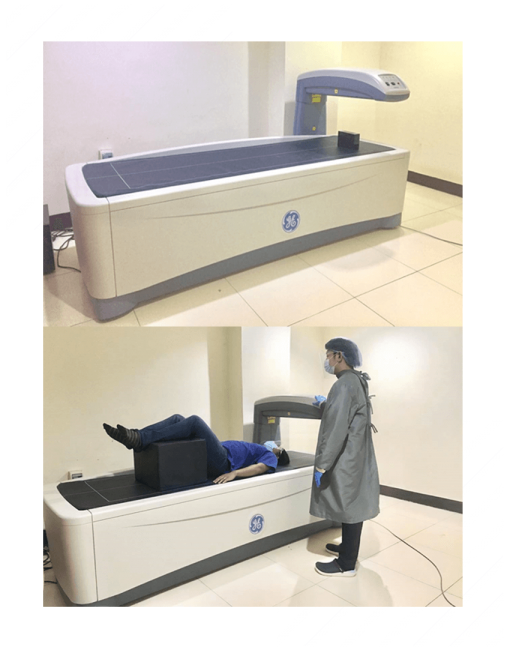 Bone mineral densitometer section image