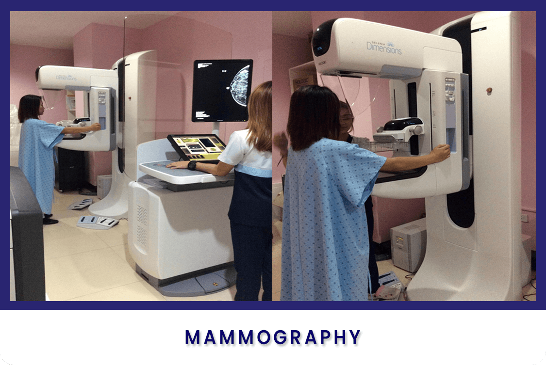 Radiology Mammography