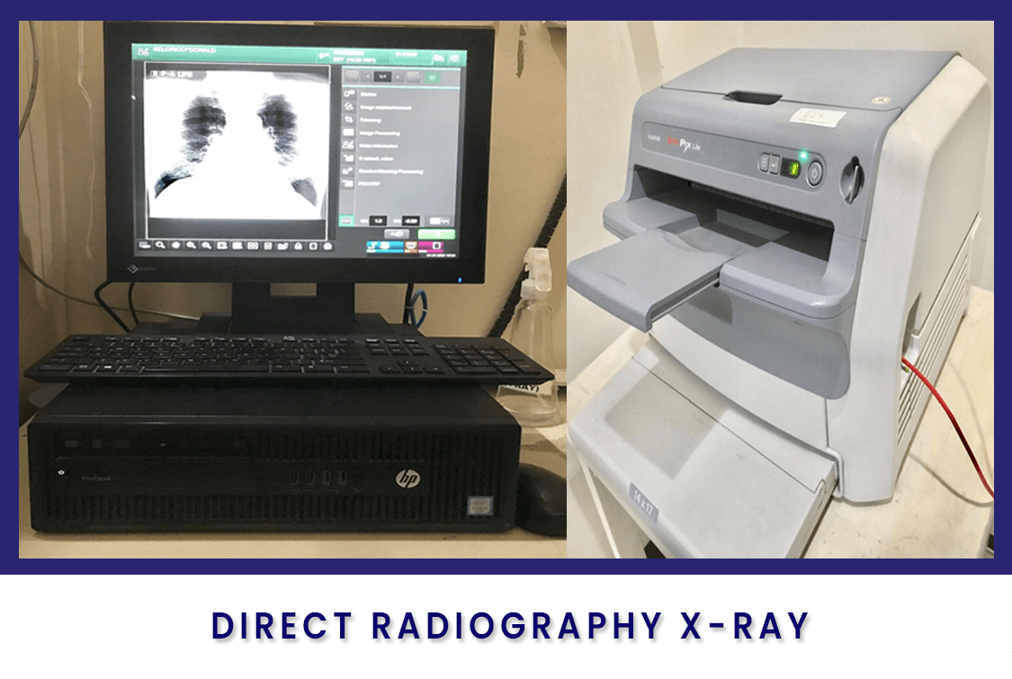Radiology Direct Radiography X-ray