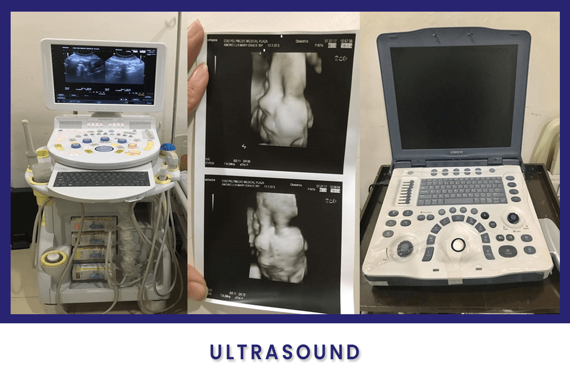 Radiology Ultrasound